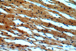 LATS2 Antibody in Immunohistochemistry (Paraffin) (IHC (P))