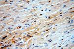 LATS2 Antibody in Immunohistochemistry (Paraffin) (IHC (P))