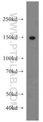 LATS2 Antibody in Western Blot (WB)