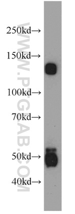 Trappc9/NIBP Antibody in Western Blot (WB)