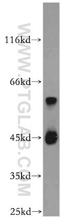B4GALT2 Antibody in Western Blot (WB)