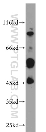 B4GALT2 Antibody in Western Blot (WB)