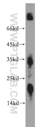 ZNF146 Antibody in Western Blot (WB)