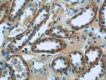 SSTR2 Antibody in Immunohistochemistry (Paraffin) (IHC (P))