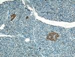 SSTR2 Antibody in Immunohistochemistry (Paraffin) (IHC (P))