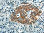 SSTR2 Antibody in Immunohistochemistry (Paraffin) (IHC (P))