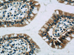 GLUT2 Antibody in Immunohistochemistry (Paraffin) (IHC (P))