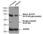 GLUT2 Antibody in Western Blot (WB)