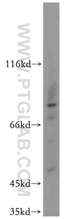 RNF6 Antibody in Western Blot (WB)