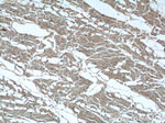 TBC1D17 Antibody in Immunohistochemistry (Paraffin) (IHC (P))