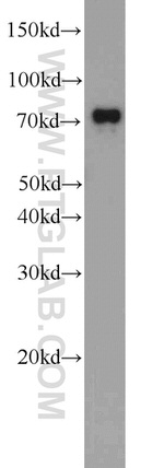 TBC1D17 Antibody in Western Blot (WB)