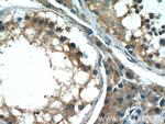 RAE1 Antibody in Immunohistochemistry (Paraffin) (IHC (P))