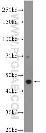 ZNF557 Antibody in Western Blot (WB)