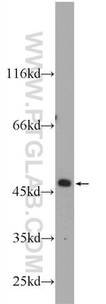 ZNF557 Antibody in Western Blot (WB)