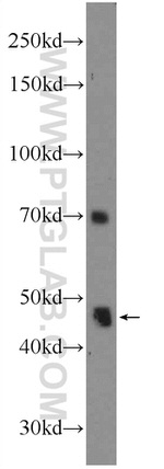 ZNF557 Antibody in Western Blot (WB)