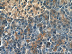 SLC11A2 Antibody in Immunohistochemistry (Paraffin) (IHC (P))