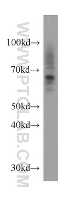 SLC11A2 Antibody in Western Blot (WB)