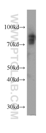 SLC11A2 Antibody in Western Blot (WB)