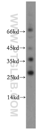 AKR1CL2 Antibody in Western Blot (WB)