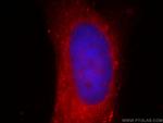 AKR1CL2 Antibody in Immunocytochemistry (ICC/IF)