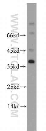 AKR1CL2 Antibody in Western Blot (WB)