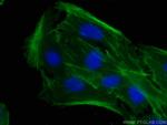 beta Actin Antibody in Immunocytochemistry (ICC/IF)