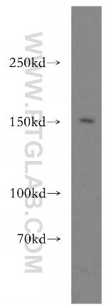 ERCC6/CSB Antibody in Western Blot (WB)