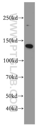 APOB Antibody in Western Blot (WB)