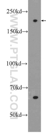 APOB Antibody in Western Blot (WB)