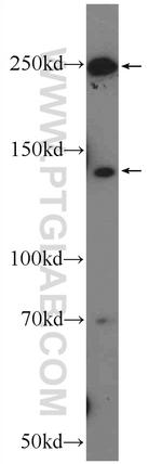 APOB Antibody in Western Blot (WB)