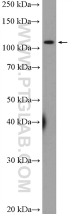 PI3K p110(beta) Antibody in Western Blot (WB)