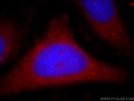 PI3K p110(beta) Antibody in Immunocytochemistry (ICC/IF)