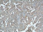 PI3K p110(beta) Antibody in Immunohistochemistry (Paraffin) (IHC (P))