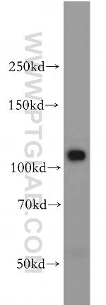 PI3K p110(beta) Antibody in Western Blot (WB)