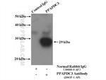 PPAPDC3 Antibody in Immunoprecipitation (IP)