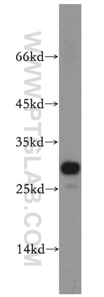 PPAPDC3 Antibody in Western Blot (WB)