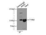 ANO2 Antibody in Immunoprecipitation (IP)