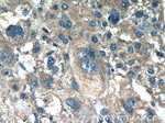 SHH Antibody in Immunohistochemistry (Paraffin) (IHC (P))