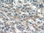 SHH Antibody in Immunohistochemistry (Paraffin) (IHC (P))