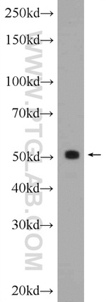 SHH Antibody in Western Blot (WB)