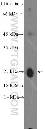 IgG light chain (lambda) Antibody in Western Blot (WB)