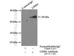 LIMS1 Antibody in Immunoprecipitation (IP)
