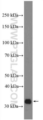 LIMS1 Antibody in Western Blot (WB)