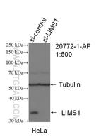 LIMS1 Antibody in Western Blot (WB)