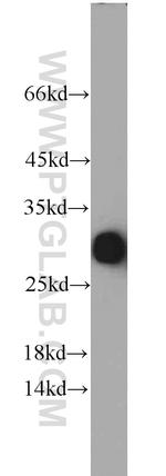 Serum amyloid P component Antibody in Western Blot (WB)