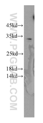 C11orf70 Antibody in Western Blot (WB)