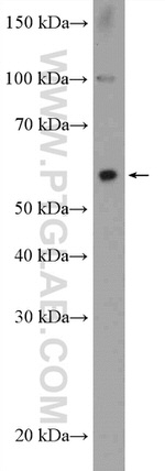 ZNF397 Antibody in Western Blot (WB)