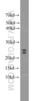 C16orf13 Antibody in Western Blot (WB)