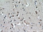 HTATSF1 Antibody in Immunohistochemistry (Paraffin) (IHC (P))