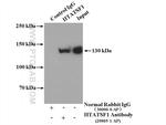 HTATSF1 Antibody in Immunoprecipitation (IP)